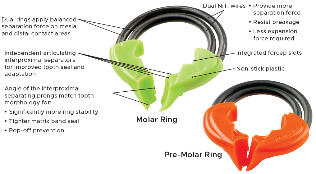 DualForce™ Molar & Pre-Molar Rings