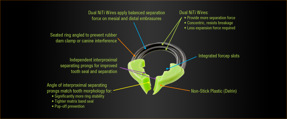 DualForce™ Molar Rings